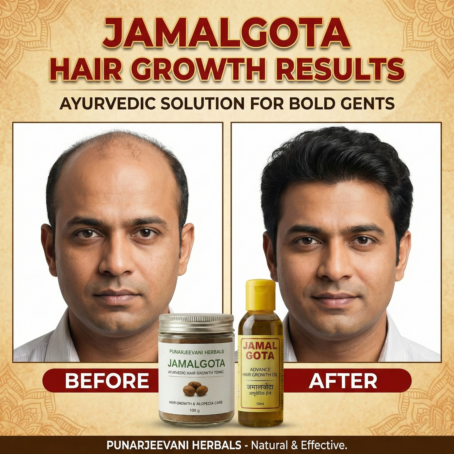 Advanced Jamalgota Herbal Hair Oil-100% Intense Hair Care
